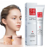 Improve Dullness Remove Dark Spot Brighten Effective Whiten Freckle Cream Melasma Fade Melanin Anti-Pigmentation Face Skin Care