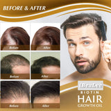 Biotin Fast Growing Hair Care Essential Oils For Men Women