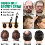 Biotin Fast Growing Hair Care Essential Oils For Men Women